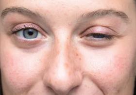 Close up of a woman's face with one eye open and another halfway shut Close up of a woman's face with one eye open and another halfway shut